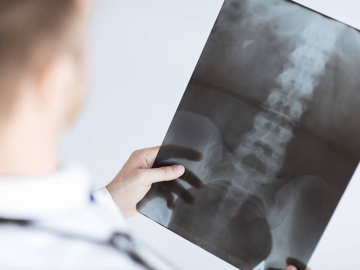 Rentgen od wynalezienia do współczesności. Przeczytaj wszystko o rentgenie od wynalezienia aż do dziś 1 Zdjęcie płuc. Obrazek w artykule Rentgen od wynalezienia do współczesności. Przeczytaj wszystko o rentgenie od wynalezienia aż do dziś